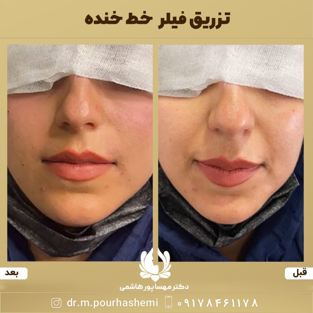 دکتر مهسا پورهاشمی
